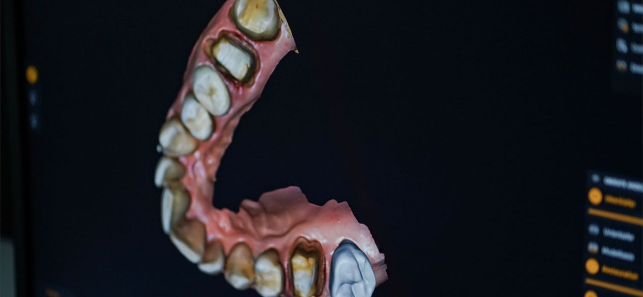 Moderne Technik – Zahnarzt Mettmann